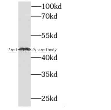 Anti-TFAP2A antibody - Click Image to Close